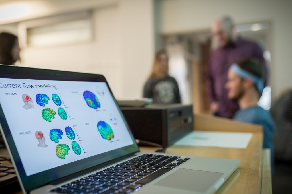 A laptop displaying images of brain scans.